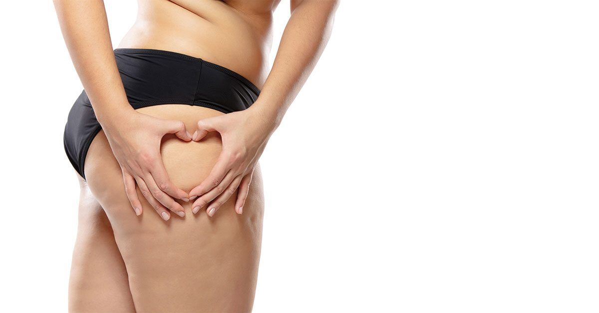 Cosa vuol dire cellulite